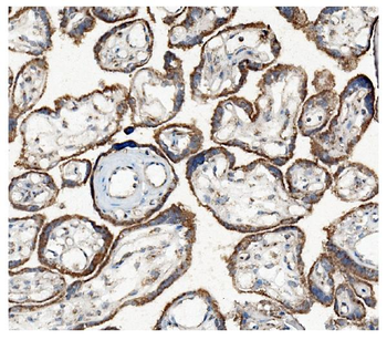 Hexokinase 1/HK1 Antibody (monoclonal, 4B7)