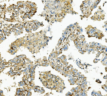 Hexokinase 1/HK1 Antibody (monoclonal, 4B7)
