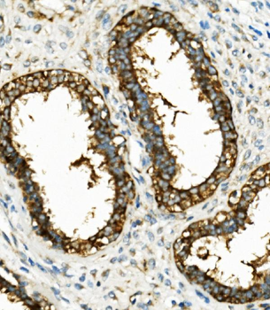 Hexokinase 1/HK1 Antibody (monoclonal, 4B7)