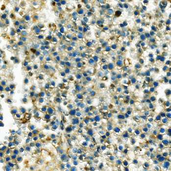 Hexokinase 1/HK1 Antibody (monoclonal, 4B7)