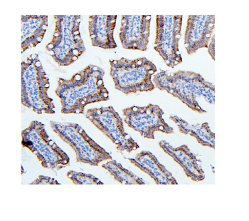 Hexokinase 1/HK1 Antibody (monoclonal, 4B7)