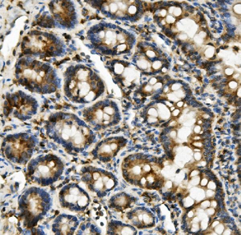 Hexokinase 1/HK1 Antibody (monoclonal, 4B7)