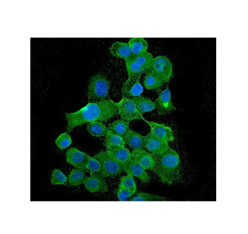 BubR1/BUB1B Mouse Monoclonal Antibody