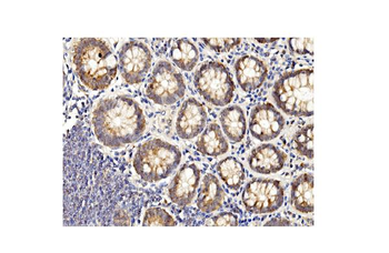 BubR1/BUB1B Mouse Monoclonal Antibody