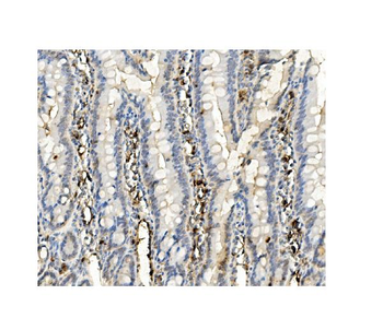 BubR1/BUB1B Mouse Monoclonal Antibody
