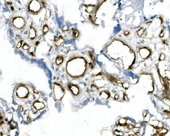 CD146/MCAM Mouse Monoclonal Antibody