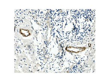 CD146/MCAM Mouse Monoclonal Antibody