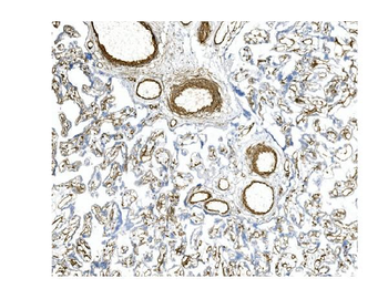 CD146/MCAM Mouse Monoclonal Antibody