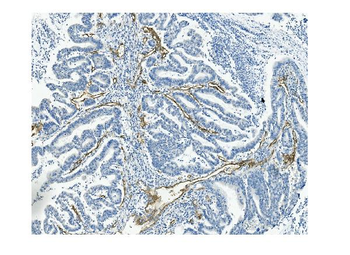 CD146/MCAM Mouse Monoclonal Antibody