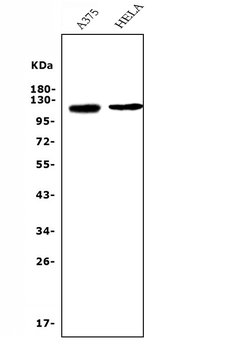 CD146/MCAM Mouse Monoclonal Antibody