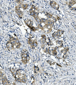 alpha 1 Catenin/CTNNA1 Mouse Monoclonal Antibody
