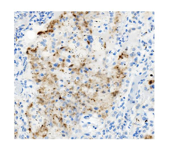 ATG4A Rabbit Polyclonal Antibody