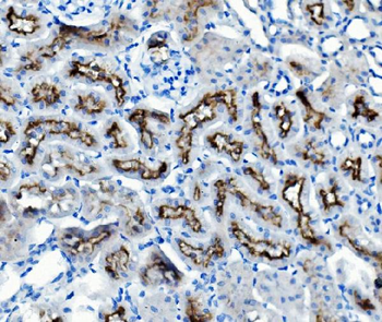 ATG7 Antibody