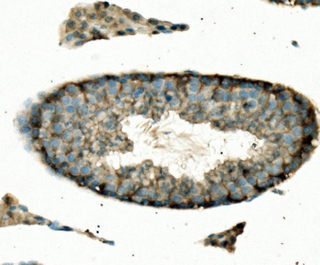 ENO1 Antibody