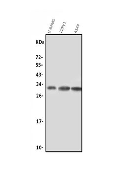NGF Rabbit Polyclonal Antibody