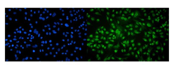 Aryl hydrocarbon Receptor/AHR Rabbit Polyclonal Antibody