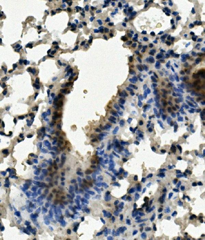 Aryl hydrocarbon Receptor/AHR Rabbit Polyclonal Antibody