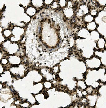 Aryl hydrocarbon Receptor/AHR Rabbit Polyclonal Antibody