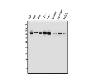 Aryl hydrocarbon Receptor/AHR Rabbit Polyclonal Antibody