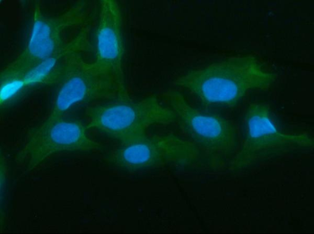 AKR1D1 Rabbit Polyclonal Antibody