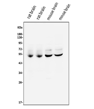 CaMKII alpha/CAMK2A Rabbit Polyclonal Antibody