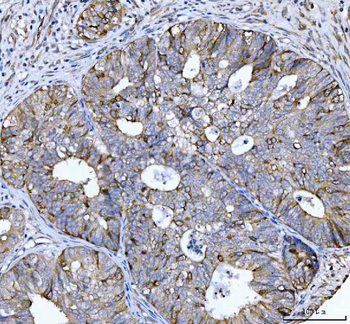 Cyclin B1/CCNB1 Antibody