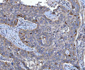 Cyclin B1/CCNB1 Antibody