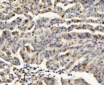Cyclin B1/CCNB1 Antibody