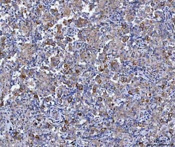 Cyclin B1/CCNB1 Antibody