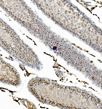 Cyclin B1/CCNB1 Antibody