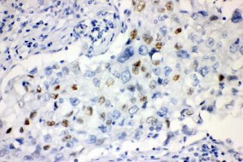 Cyclin E1/CCNE1 Rabbit Polyclonal Antibody