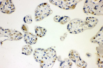 Cyclin E1/CCNE1 Rabbit Polyclonal Antibody