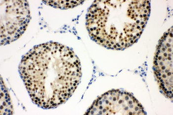 Cyclin E1/CCNE1 Rabbit Polyclonal Antibody