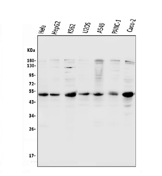 Cyclin E1/CCNE1 Rabbit Polyclonal Antibody