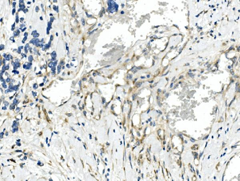 CDR2 Rabbit Polyclonal Antibody