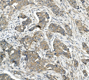 CDR2 Rabbit Polyclonal Antibody