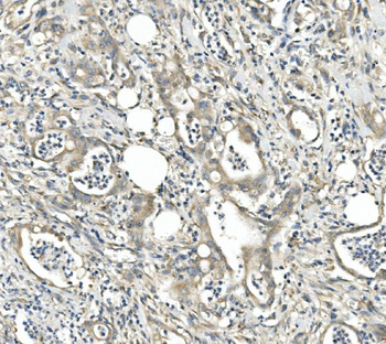 CDR2 Rabbit Polyclonal Antibody