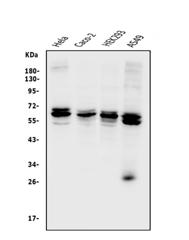 CDR2 Rabbit Polyclonal Antibody