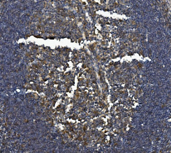 IL-3RB/Csf2rb Antibody