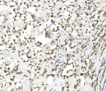 DDIT3 Rabbit Polyclonal Antibody
