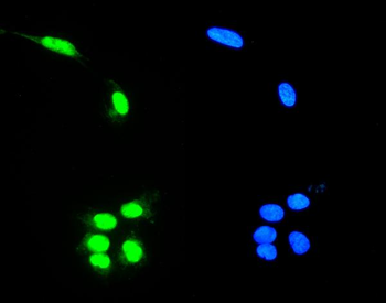 RNA Helicase A/DHX9 Antibody