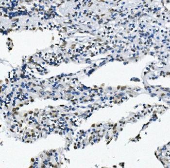 RNA Helicase A/DHX9 Antibody