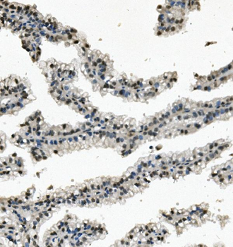 RNA Helicase A/DHX9 Antibody