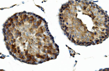 DNAJA2 Antibody
