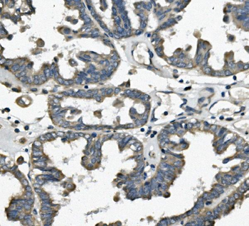 TTC11/FIS1 Antibody