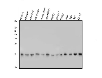 TTC11/FIS1 Antibody