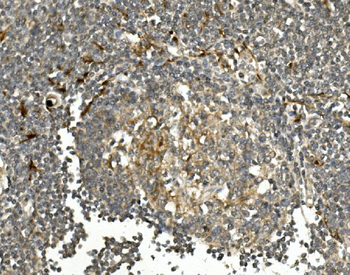 HGS Rabbit Polyclonal Antibody