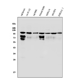 HGS Rabbit Polyclonal Antibody