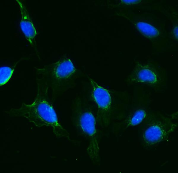 IFT88 Rabbit Polyclonal Antibody