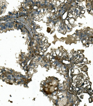 IFT88 Rabbit Polyclonal Antibody